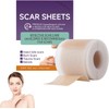 Cinta de silicona para cicatrices DMMYBJ – Reduce y previene
