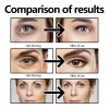 Crema Reparadora Instantánea Para El Estiramiento Facial Con