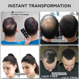 THICK FIBER Hair Fibers for Thinning Hair & Bald spots (BLACK) - 25g Bottle - Conceals Hair Loss in Seconds - Hair Powder for Women & Men