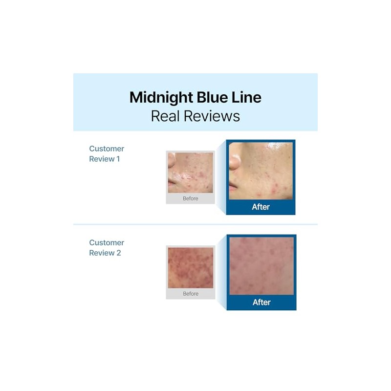 Midnight Blue Calming Cream 60 ml, For oily, acne prone