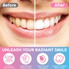 Niacinamide Toothpaste Niacinamide Intensive Whitening Toothpaste Deep Gentle Cleaning Tooth