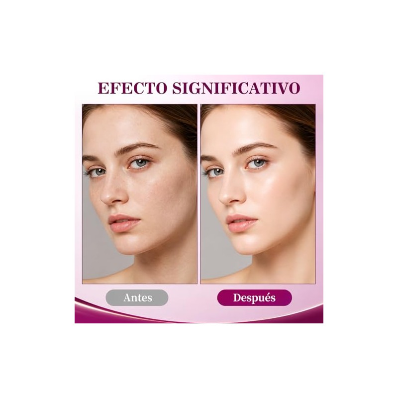 Cemenrete Calcium MultiBalm, Bálsamo Calcium, Bálsamo Multi Volumen de Calcio,