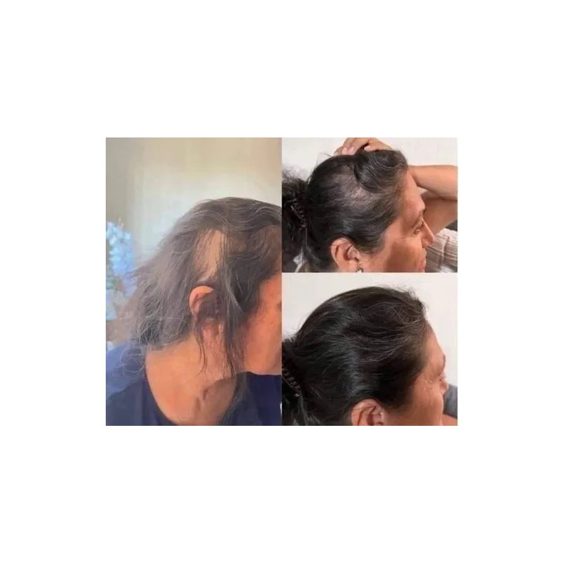 3 Piezas Shampoo Reviving - Farmasi - Set Reviving