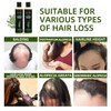 Tgideas Organic Rosemary Hair Growth Shampoo for Women and Men-Natural