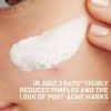 Cerave Limpiador Facial Mascarilla Para Acne 118 Ml Acneica Día/noche