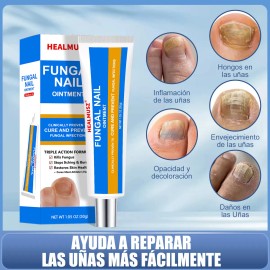 Para Uñas De Manos Y Pies-crema Para Hongos En Las Uñas Ndc