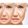 Pro-gest-emerita-4 Onzas Crema Progest-cuidado Personal-cara