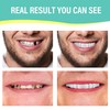 4 Pairs Upper Lower Teeth Veneer Tooth Covers Oral Whitening