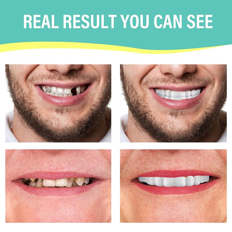 4 Pairs Upper Lower Teeth Veneer Tooth Covers Oral Whitening