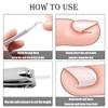 42 Piece Ingrown Toenail Set, Ingrown Toenail Lifter, Toenail Correction
