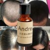 Andrea Paquete 5pza Andrea Solución Crecimiento Del Cabello Full