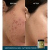 Edible Beauty Inner Essentials - Skin + Gut Renew Powder