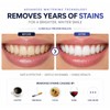 LUNAR Teeth Whitening Strips, 28 Strips, Enamel Safe, Non Sensitive