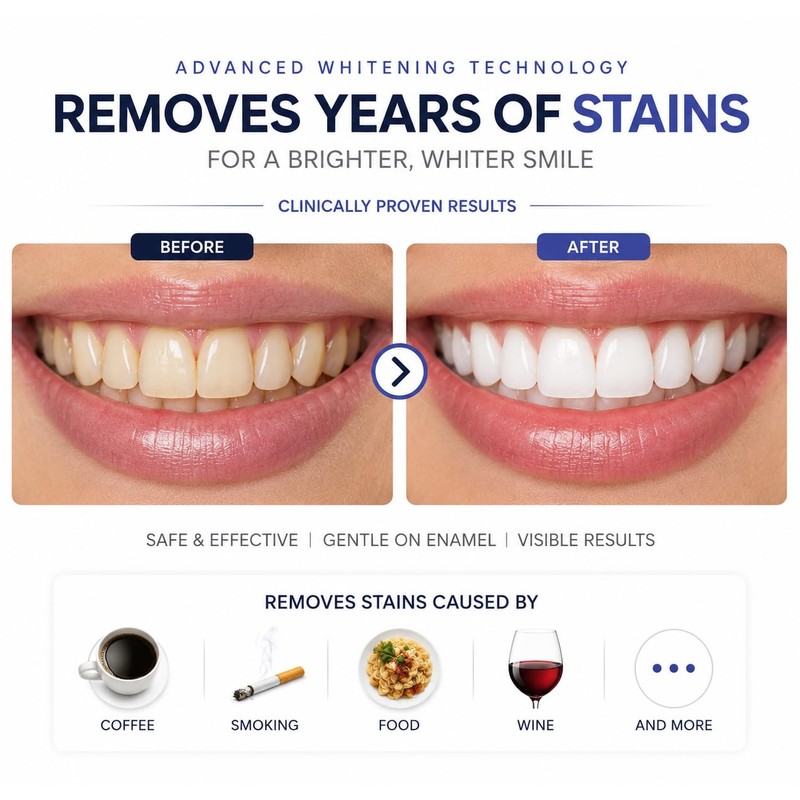 LUNAR Teeth Whitening Strips, 28 Strips, Enamel Safe, Non Sensitive