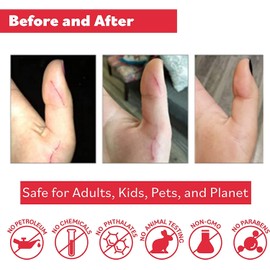 Puremedy Original Healing Ointment All Natural First Aid Salve for Wounds, Burns, Cuts, Bug Bites, Bed Sores, Itching, Swelling - Safe for Adults & Kids, FSA - 1 oz