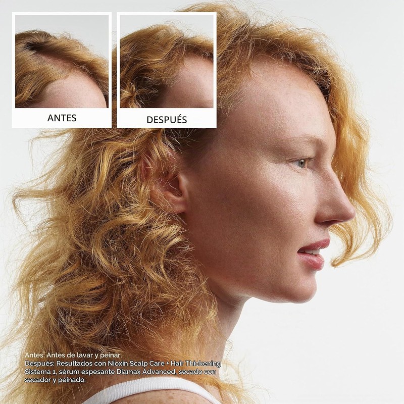 Nioxin Tratamiento Leave-In para Cuero Cabelludo y Cabello fino –