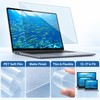 Anti-Blue Light Laptop Screen Protector – Matte Anti-Reflective PET Film