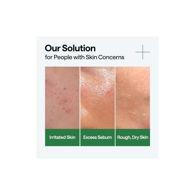 MEDIHEAL Teatree Calming Serum - Soothing & Moisturizing Care. Hyaluronic