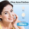 QUSTERE Pimple Patches for Face, Hydrocolloid Acne Patches, Cute Round