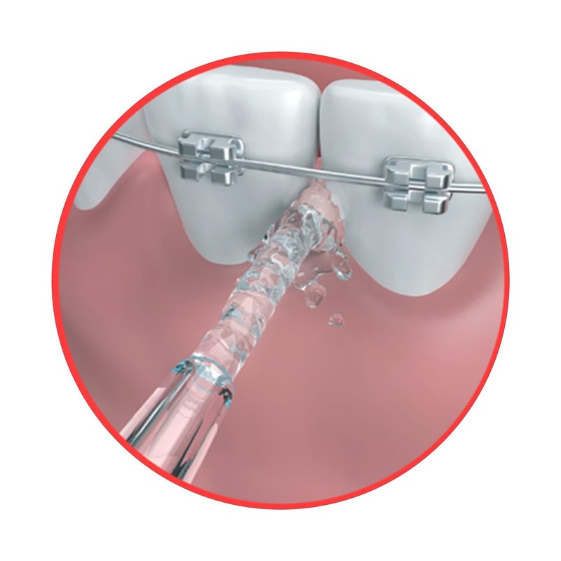 GO2 Dentagenie Portable Water Flosser