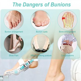 BAKENLON Hallux Valgus Correction Adjustable Button, 1 Piece Hallux Valgus Correction Set, Hallux Valgus Bunion Corrector, Hallux Valgus Bunion Corrector for Day & After Toes, Unisex