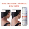 Crema Despigmentante Para Manchas, Melasma, Acné Y Paño Skid