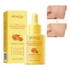 Sérum Facial Bioaqua de Cúrcuma con Ácido Hialurónico para Iluminar