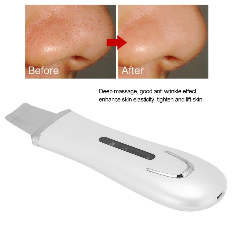 Ultrasonic Face Skin Scrubber Blackhead Removal Ion Cleaner Facial Cleanser