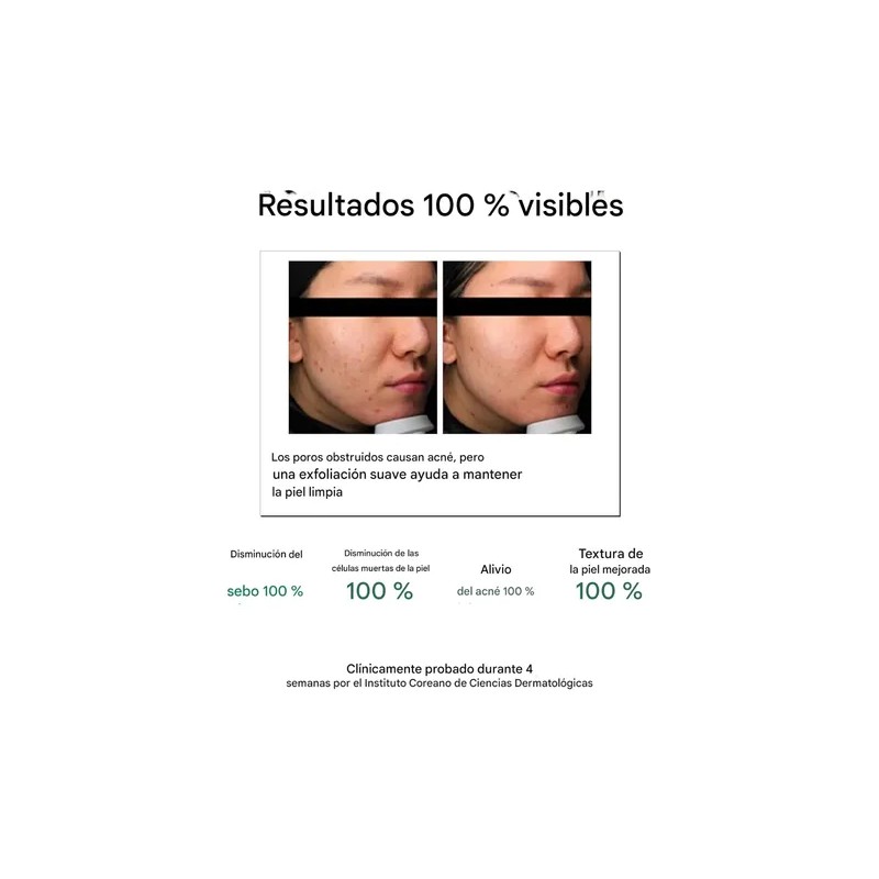 Tónico Exfoliante 30 Days Miracle 150ml Some By Mi