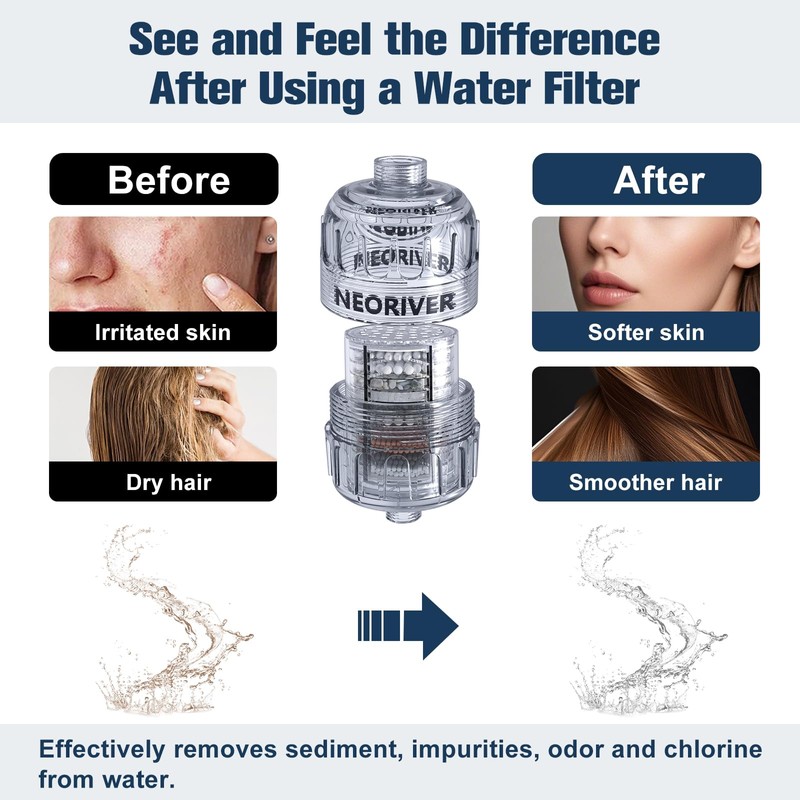 High Output Revitalizing Shower Filter - Reduces Dry Itchy Skin,