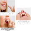 MYOSPOTS Tongue Exercise Spots – Myofunctional Therapy Tool for Correct