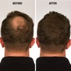 Infinity Hair Fiber – Corrector de pérdida de cabello –