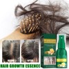 30ml 4PCS Ginger Hair Growth Spray Nutritious Moisturizing Hair Root