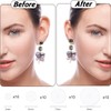 AFCJLTO 40 Pieces Keloid Discs for Earring Stabilizer, Ear Lobe