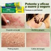 Crema De Psoriasis Para Varios Síntomas De Psoriasis 20g