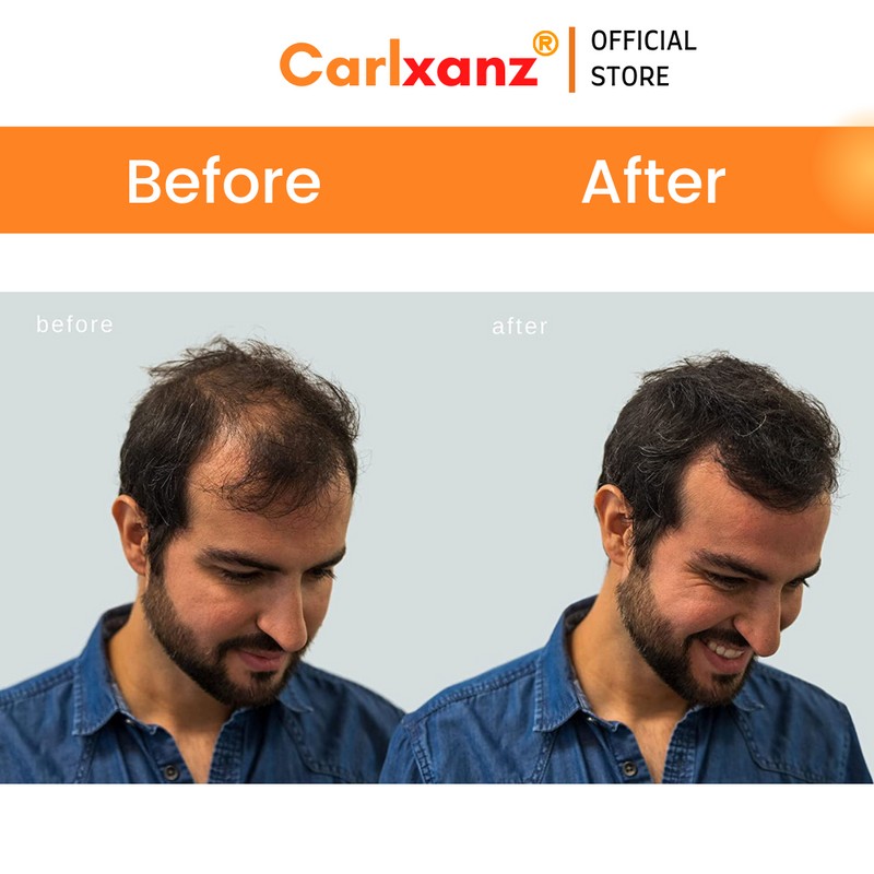 Carlxanz Hair Fiber Classic (4 x 25g)
