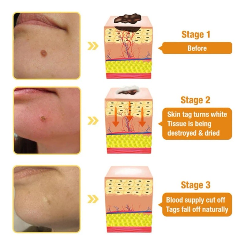 Crema De Tratamiento Para La Piel De Abeja, All Parts