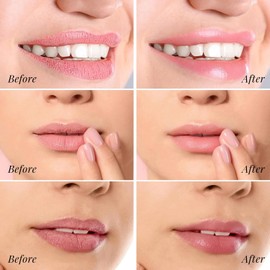 Lip Mask + Lip Scrub, Lip Scrub, 4P Lip Care Set with 3 Lip Sleeping Masks, Lip Mask Overnight, Lip Balm Set for Dry, Brittle, Cracked Lips, Fine Lines & Wrinkles