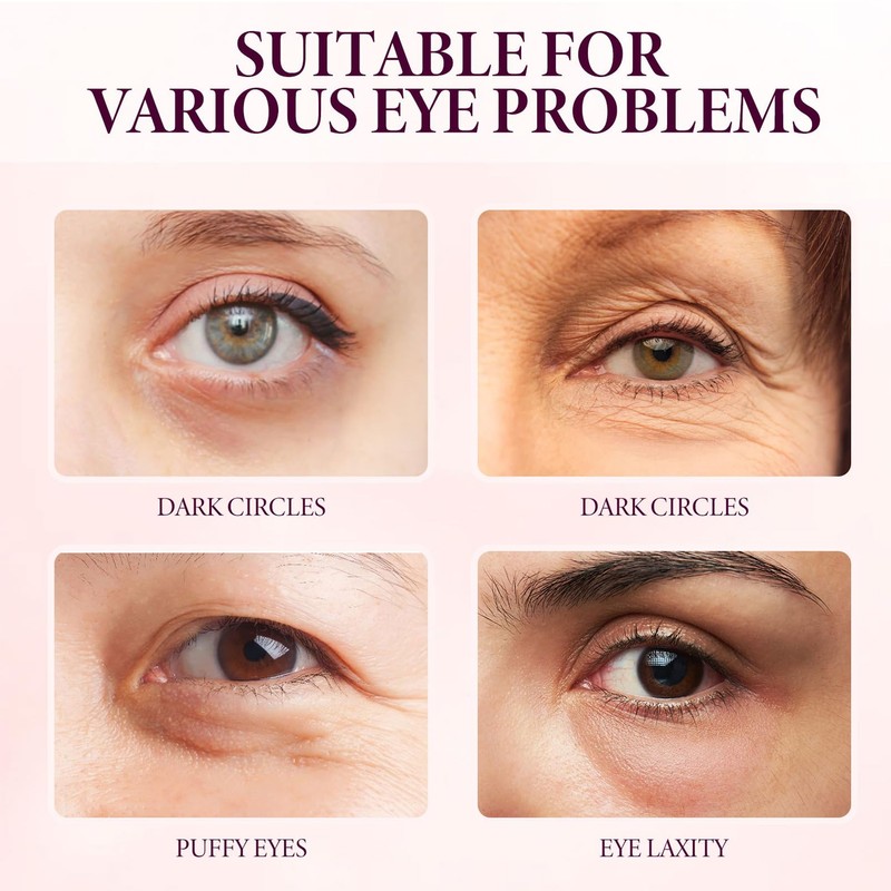 Eyelift Serum Mango Revitalize Eye Cream,Under Eye Cream for Dark