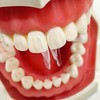 10 pcs/Pack Dental Clear Matrix Anterior Posterior Fit Bioclear BT