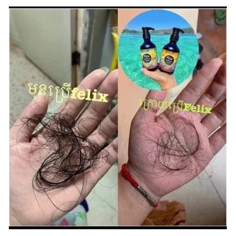 Felix 1 Set Felix Professional Hair Care ឈុតសាប៊ូកក់សក់