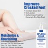 60% Urea Cream,Urea Foot Cream,Foot Cream for Cracked Heels and