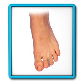 Bunga Pads Toe Separator - Medium