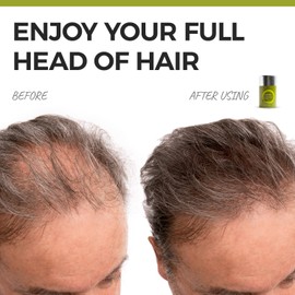 Hair Fibers for Thinning Hair - Volumizing Hair Fillers Are an Undetectable Instant & Safe Root Cover Up - Natural Keratin Protein Adds Texture to Sparse Hair - 18g / 0.63oz (Dark Brown)