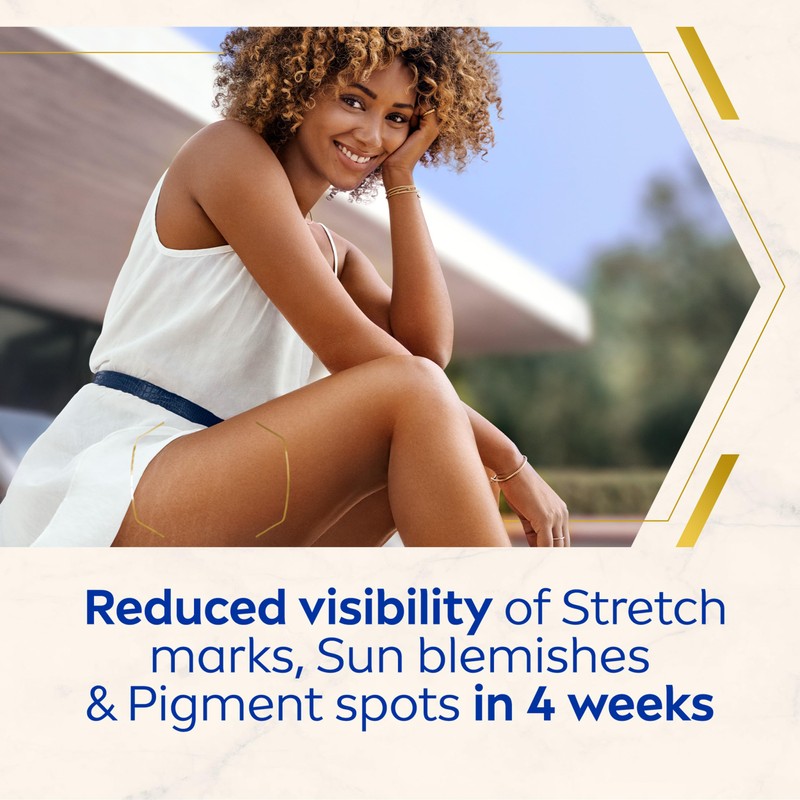 NIVEA Luminous 630 Anti Stretch Marks & Dark Spots Body