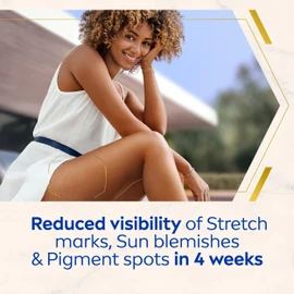 NIVEA Luminous 630 Anti Stretch Marks & Dark Spots Body Cream (200ml), 48-Hour Moisturising Cream Reduces Stretch Marks, Sun Blemishes and Pigment Spots