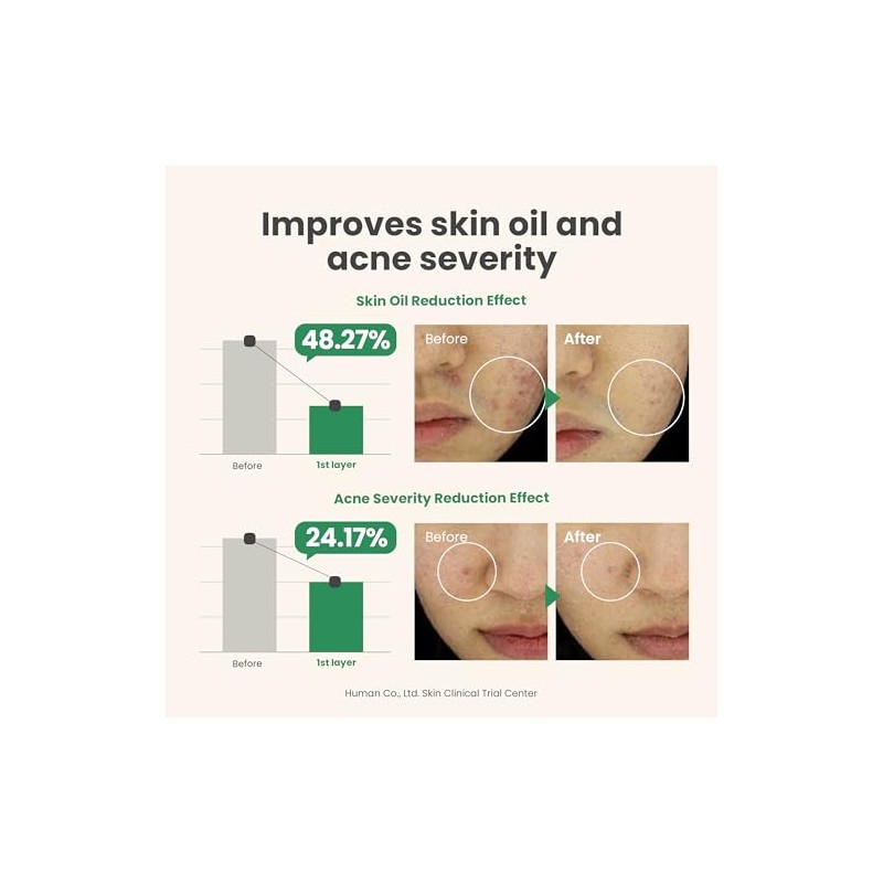 AXIS-Y Spot the Difference Blemish Treatment - Tratamiento anti brotes