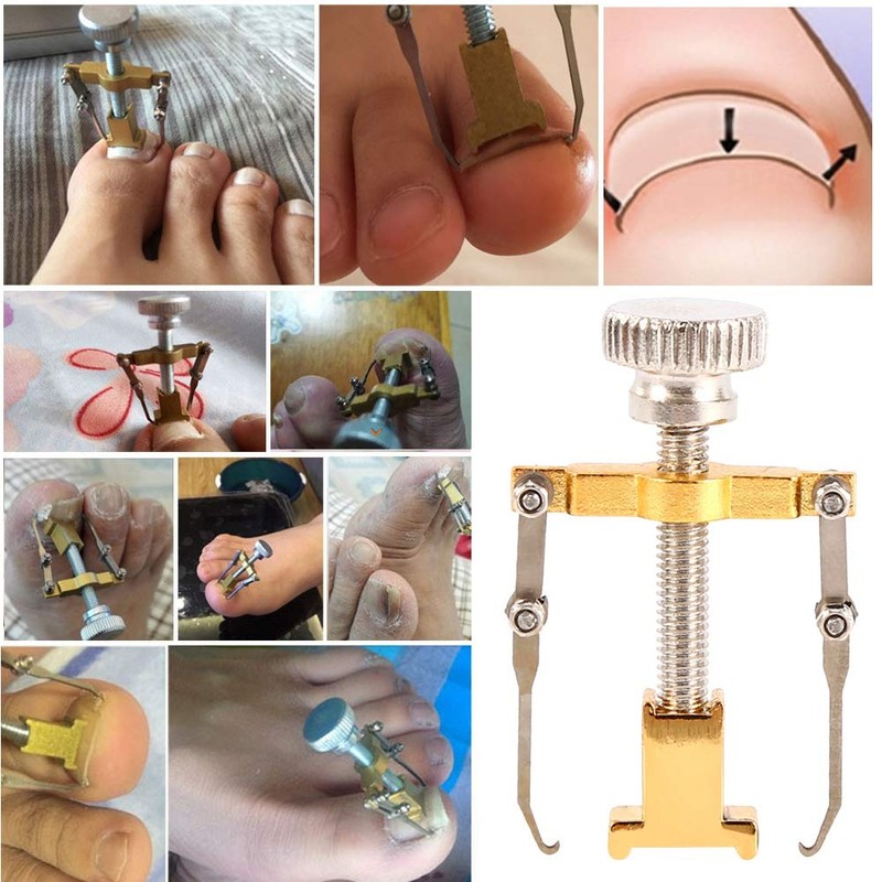 Ingrown Toenail Corrector, Practical Ingrown Toenail Tool Nail Kit Toe