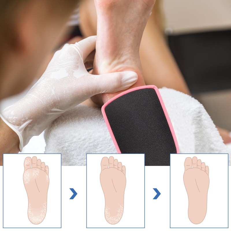 Healeved 2pcs Double-sided Foot File Callus Remover Tool for Dead