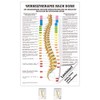 Bolt Mini poster Therapy Medical Educational Anatomy 34x24 cm mittel